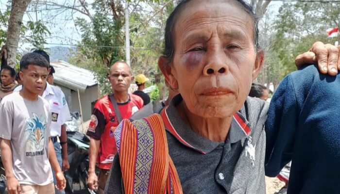 Oknum Guru di TTS Diduga Aniaya Nenek Lansia di Pasar Oinlasi